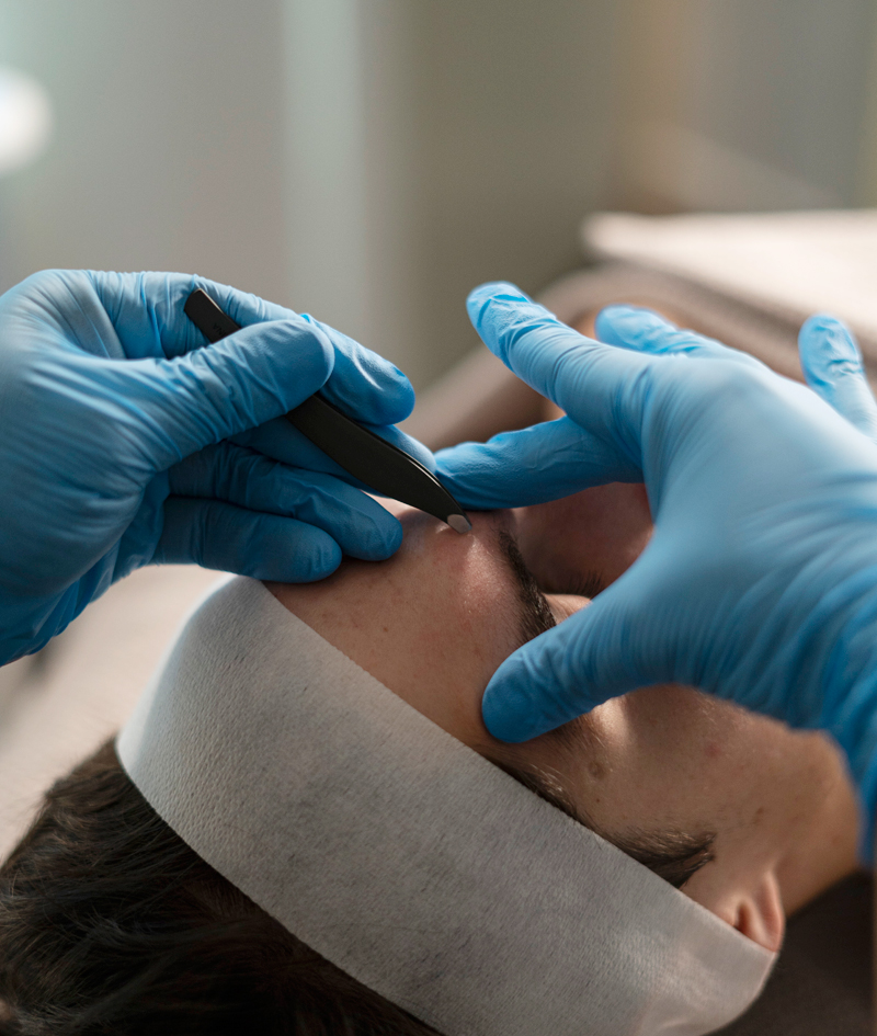 Tratamientos ALATO: MEN’S EYEBROW. Tratamientos ALATO: MEN’S EYEBROW.