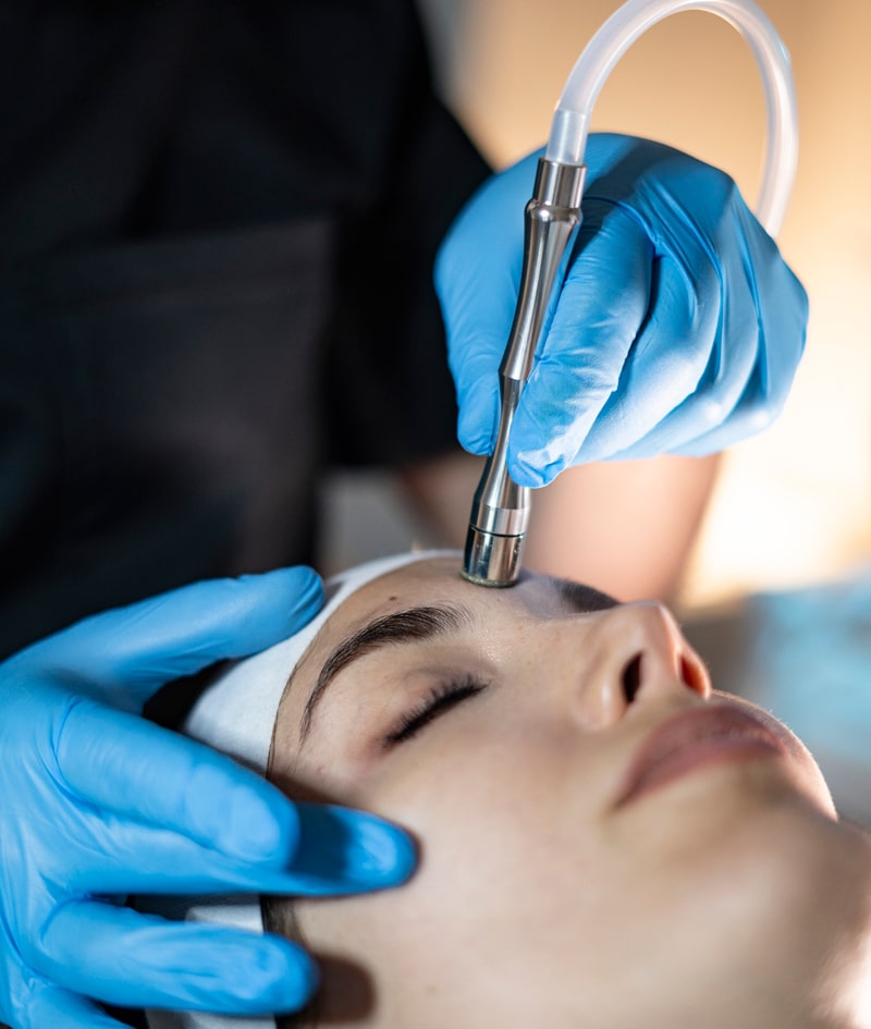 Tratamientos Alato: MICRODERMABRASION: LIMPIEZA PROFUNDA / DEEP CLEAN-1 Tratamientos Alato: MICRODERMABRASION: LIMPIEZA PROFUNDA / DEEP CLEAN-1