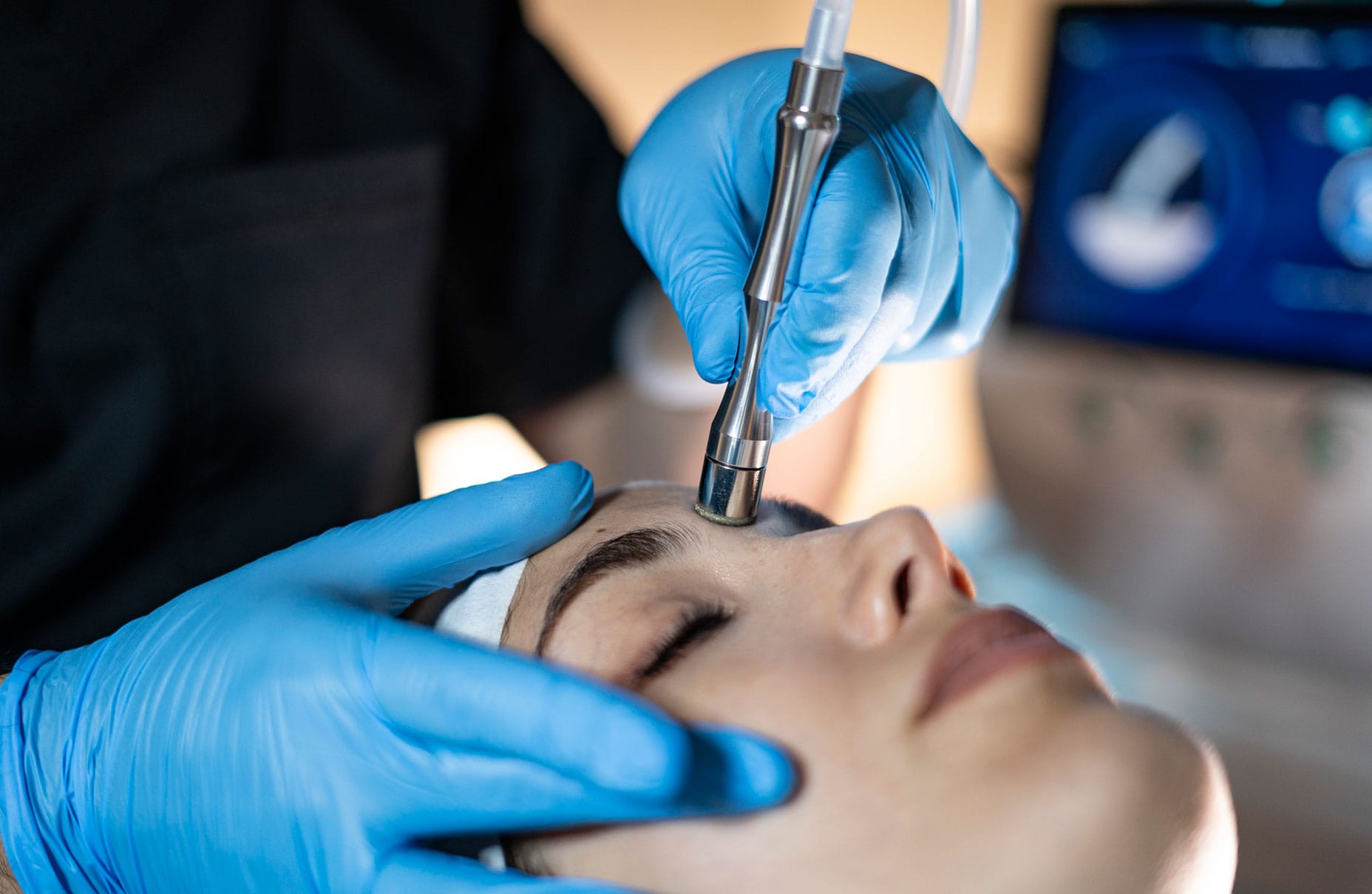 Tratamientos Alato: MICRODERMABRASION: LIMPIEZA PROFUNDA / DEEP CLEAN-3 Tratamientos Alato: MICRODERMABRASION: LIMPIEZA PROFUNDA / DEEP CLEAN-3